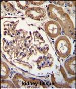 CD249 Antibody in Immunohistochemistry (Paraffin) (IHC (P))