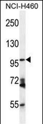 CD249 Antibody in Western Blot (WB)