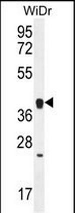 OR2T8 Antibody in Western Blot (WB)