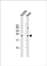 SDHD Antibody in Western Blot (WB)