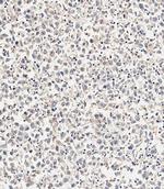 ASM Antibody in Immunohistochemistry (Paraffin) (IHC (P))