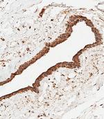 ASM Antibody in Immunohistochemistry (Paraffin) (IHC (P))