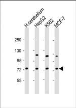 ASM Antibody in Western Blot (WB)