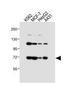 ASM Antibody in Western Blot (WB)