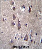 PCDHB12 Antibody in Immunohistochemistry (Paraffin) (IHC (P))