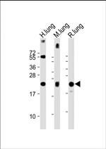 SFTPC Antibody in Western Blot (WB)