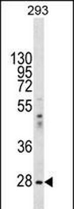 eIF2b alpha Antibody in Western Blot (WB)