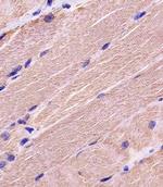 MYBPC3 Antibody in Immunohistochemistry (Paraffin) (IHC (P))