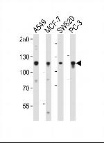 GAA Antibody in Western Blot (WB)