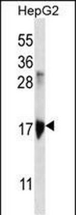 KRTAP1-3 Antibody in Western Blot (WB)