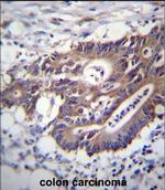 Cytokeratin 12 Antibody in Immunohistochemistry (Paraffin) (IHC (P))