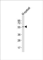 Cytokeratin 12 Antibody in Western Blot (WB)