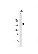 Cytokeratin 12 Antibody in Western Blot (WB)