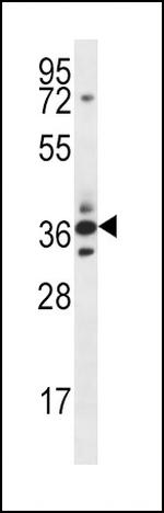 SFRP5 Antibody in Western Blot (WB)