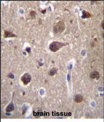 MRAP2 Antibody in Immunohistochemistry (Paraffin) (IHC (P))