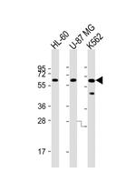 IL1RL2 Antibody in Western Blot (WB)