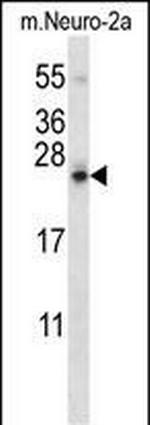 SDF2L1 Antibody in Western Blot (WB)