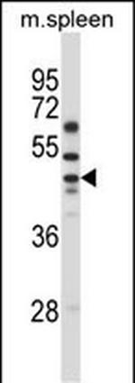 SLC30A6 Antibody in Western Blot (WB)