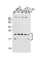 UBE2W Antibody in Western Blot (WB)