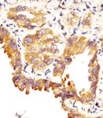 SFTPC Antibody in Immunohistochemistry (Paraffin) (IHC (P))