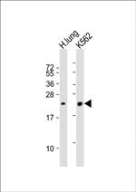 SFTPC Antibody in Western Blot (WB)