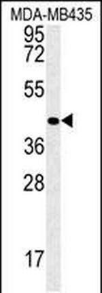 VASH2 Antibody in Western Blot (WB)