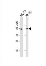 LPL Antibody in Western Blot (WB)