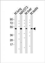 MLKL Antibody in Western Blot (WB)