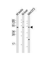 MLKL Antibody in Western Blot (WB)