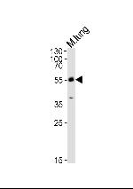 MLKL Antibody in Western Blot (WB)