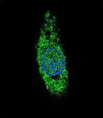 LIN28B Antibody in Immunocytochemistry (ICC/IF)