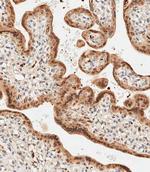 LIN28B Antibody in Immunohistochemistry (Paraffin) (IHC (P))