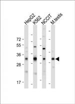 LIN28B Antibody in Western Blot (WB)