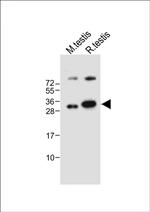 LIN28B Antibody in Western Blot (WB)