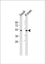 GPR30 Antibody in Western Blot (WB)