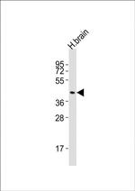 DRD2 Antibody in Western Blot (WB)