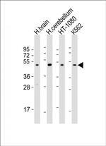 DRD2 Antibody in Western Blot (WB)