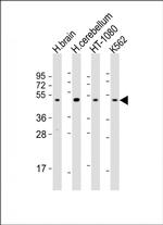 DRD2 Antibody in Western Blot (WB)