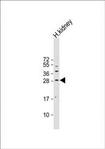 Sclerostin Antibody in Western Blot (WB)