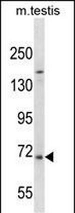 EXTL1 Antibody in Western Blot (WB)