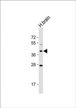 OR5M8 Antibody in Western Blot (WB)