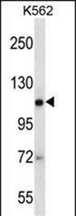 AGO2 Antibody in Western Blot (WB)