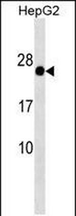 GAGE12F/GAGE12G/GAGE12I Antibody in Western Blot (WB)