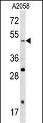 SOX4 Antibody in Western Blot (WB)