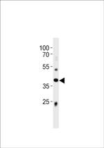 ABI3 Antibody in Western Blot (WB)