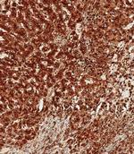 Cathepsin D Antibody in Immunohistochemistry (Paraffin) (IHC (P))