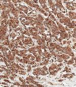 Cathepsin D Antibody in Immunohistochemistry (Paraffin) (IHC (P))