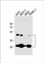 Cathepsin D Antibody in Western Blot (WB)