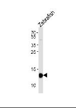 HBAE1 Antibody in Western Blot (WB)