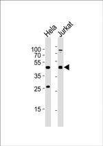 AVPR2 Antibody in Western Blot (WB)